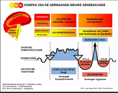 Germaanse geneeskunde